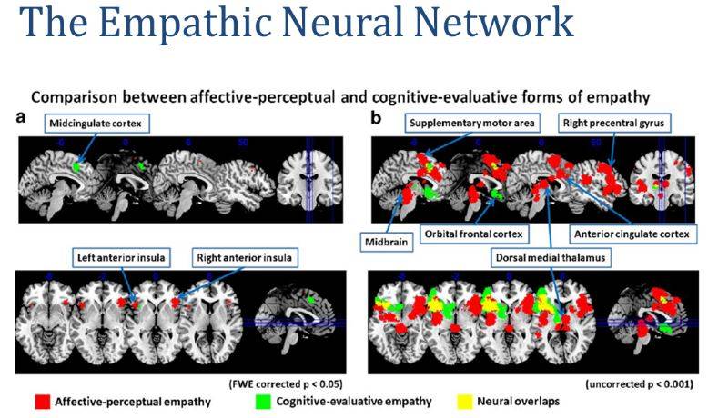The Emphatic Neural Network
